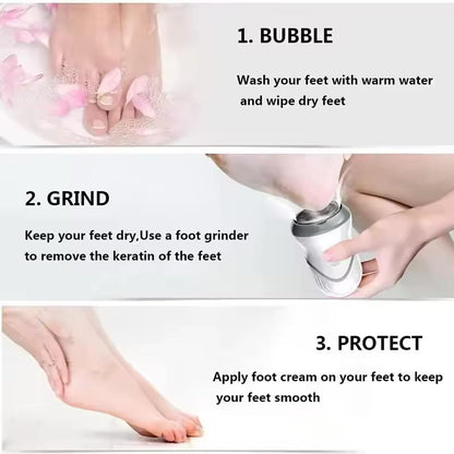 Electric Foot Callus Remover – Rechargeable Pedicure Grinder for Smooth & Soft Feet Zyntorr